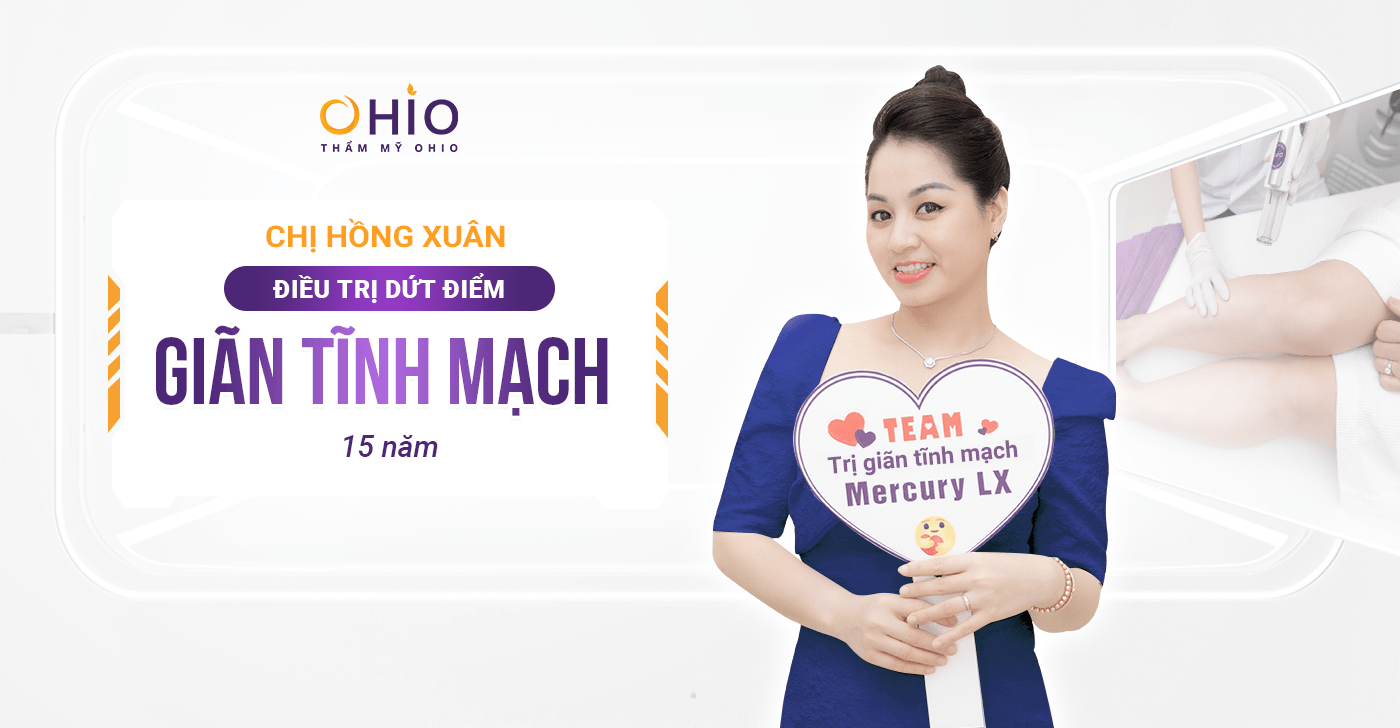 dấu hiệu giãn tĩnh mạch 5