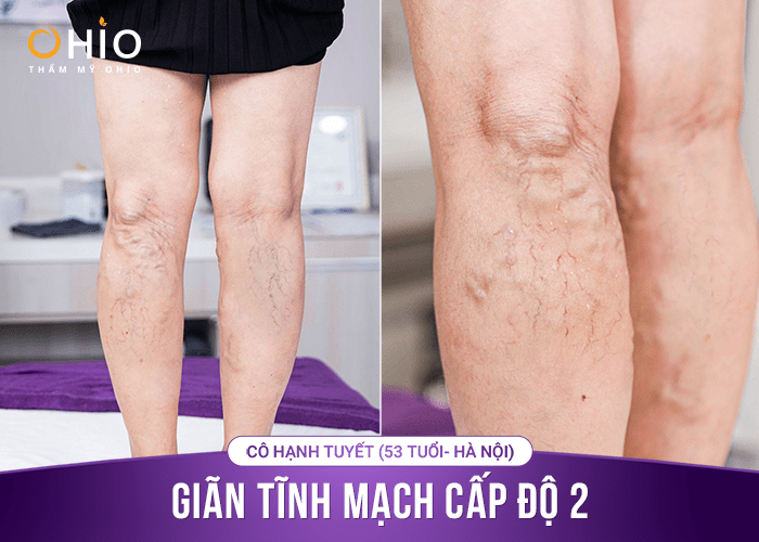 Cô Hạnh Tuyết GTM 3