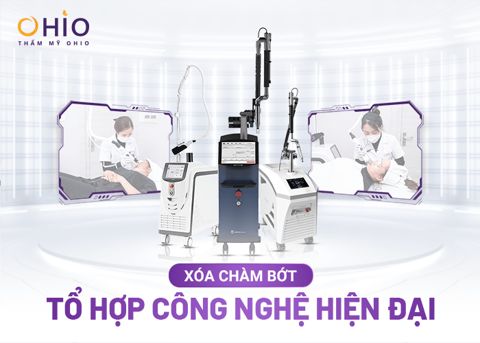 Vết chàm đỏ bẩm sinh 2