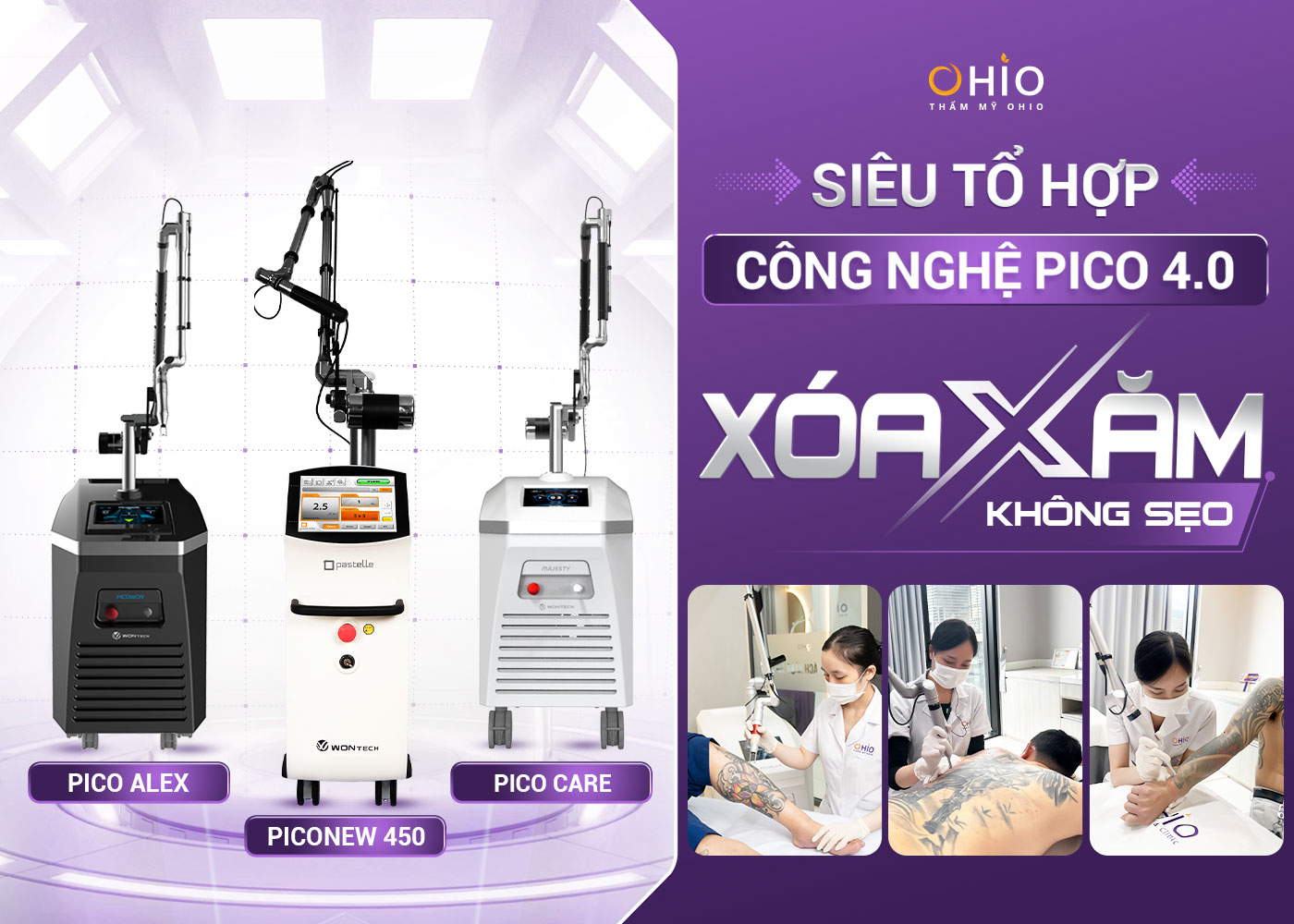 Siêu tổ hợp Công nghệ PICO 4.0 Xóa xăm không sẹo