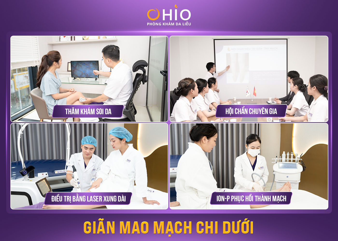 Quy trình trị giãn mao mạch chi dưới