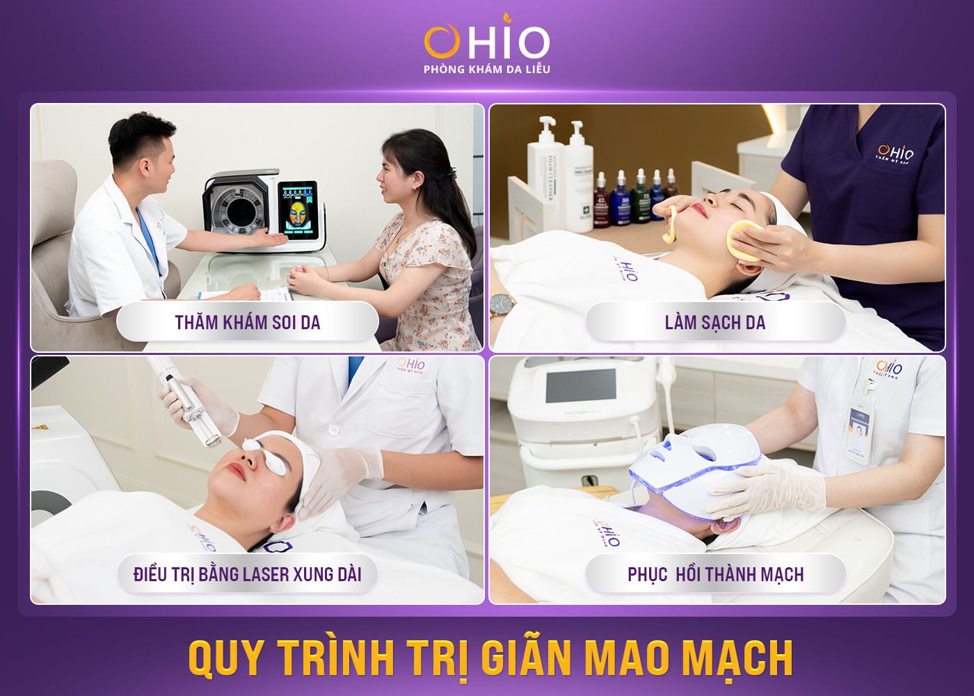 Quy trình trị giãn mao mạch với Tổ hợp công nghệ Laser xung dài