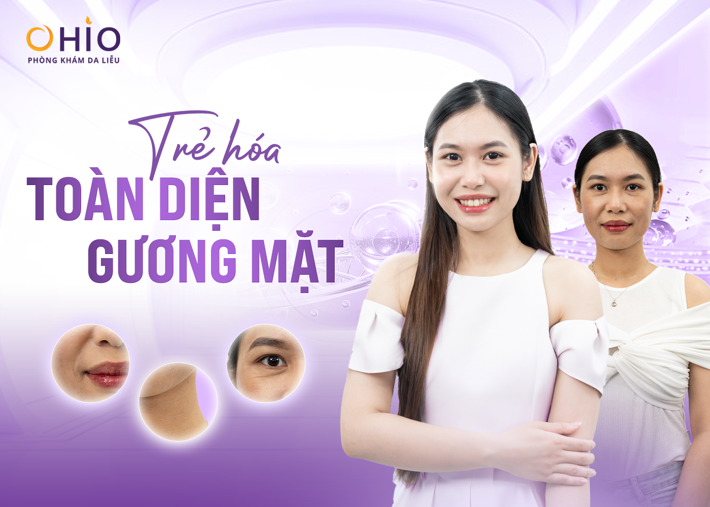 Trẻ hóa toàn diện gương mặt bằng công nghệ Ultherapy 