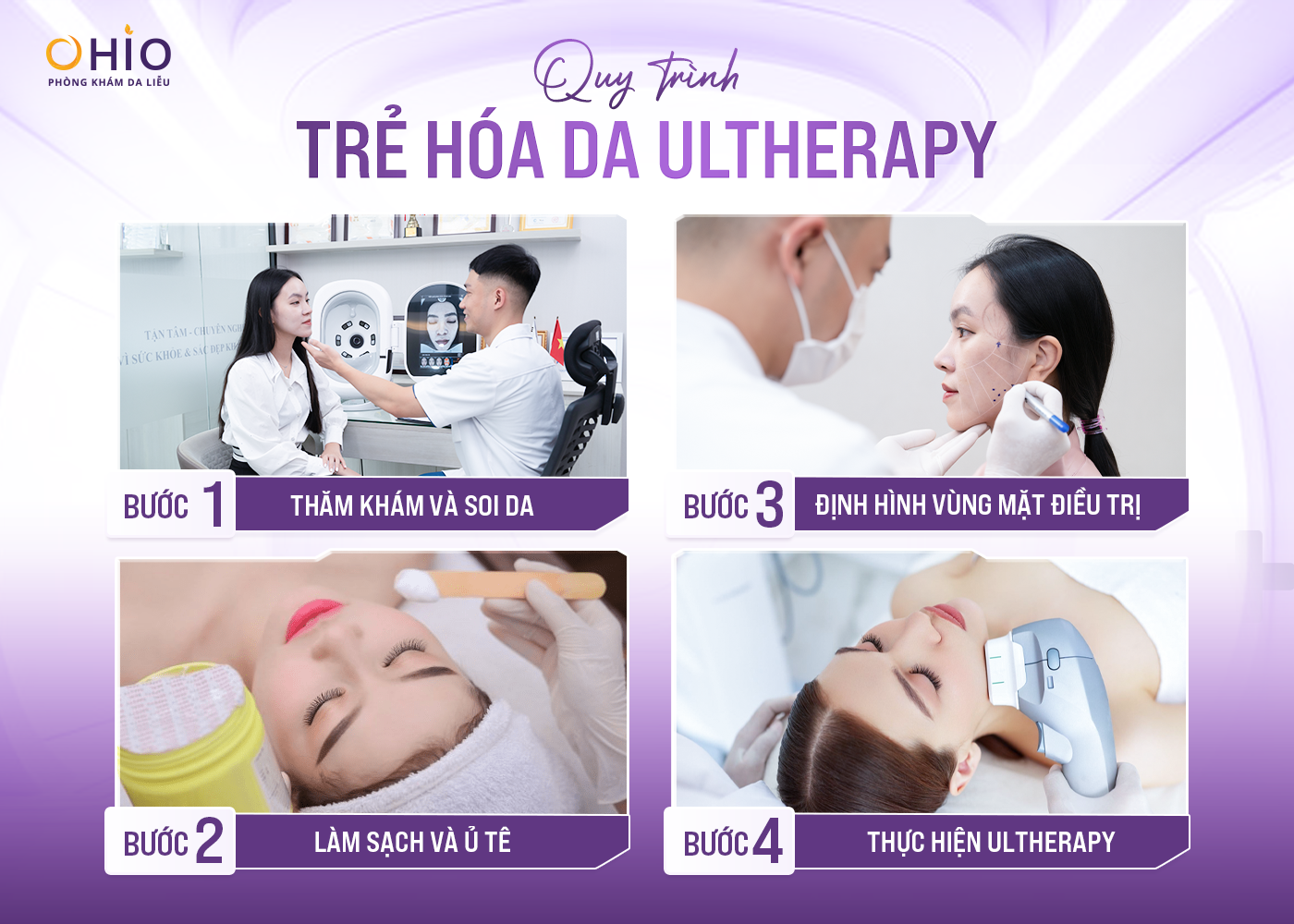 quy trình trẻ hóa bằng công nghệ Ultherapy