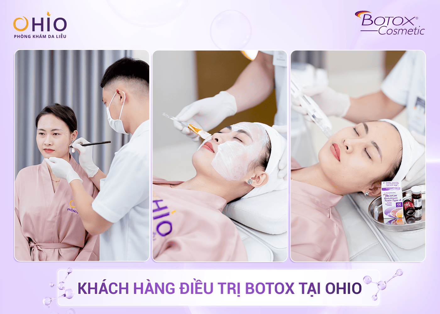 Quy trình điều trị chuẩn y khoa OHIO