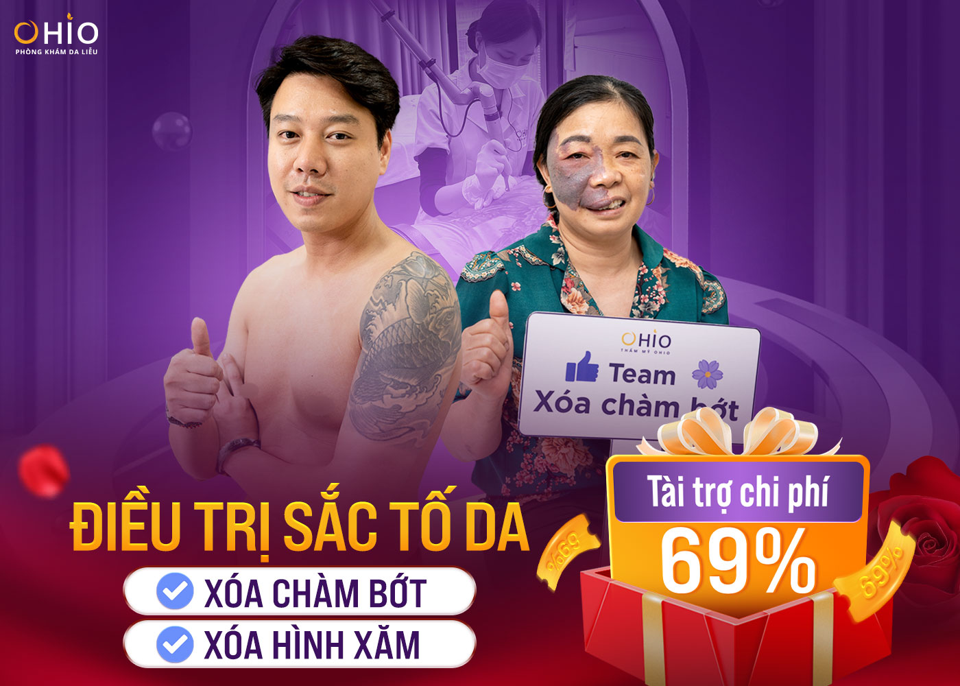 Điều trị sắc tố - Ưu đãi 69%